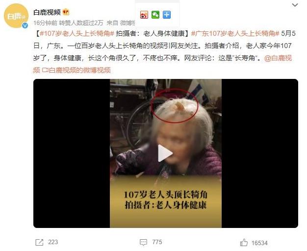 107歲老人頭上長壽角，身體健康引網友關注