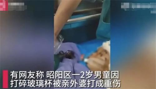 2歲男童因打碎玻璃杯遭外婆暴力毆打，生命岌岌可危